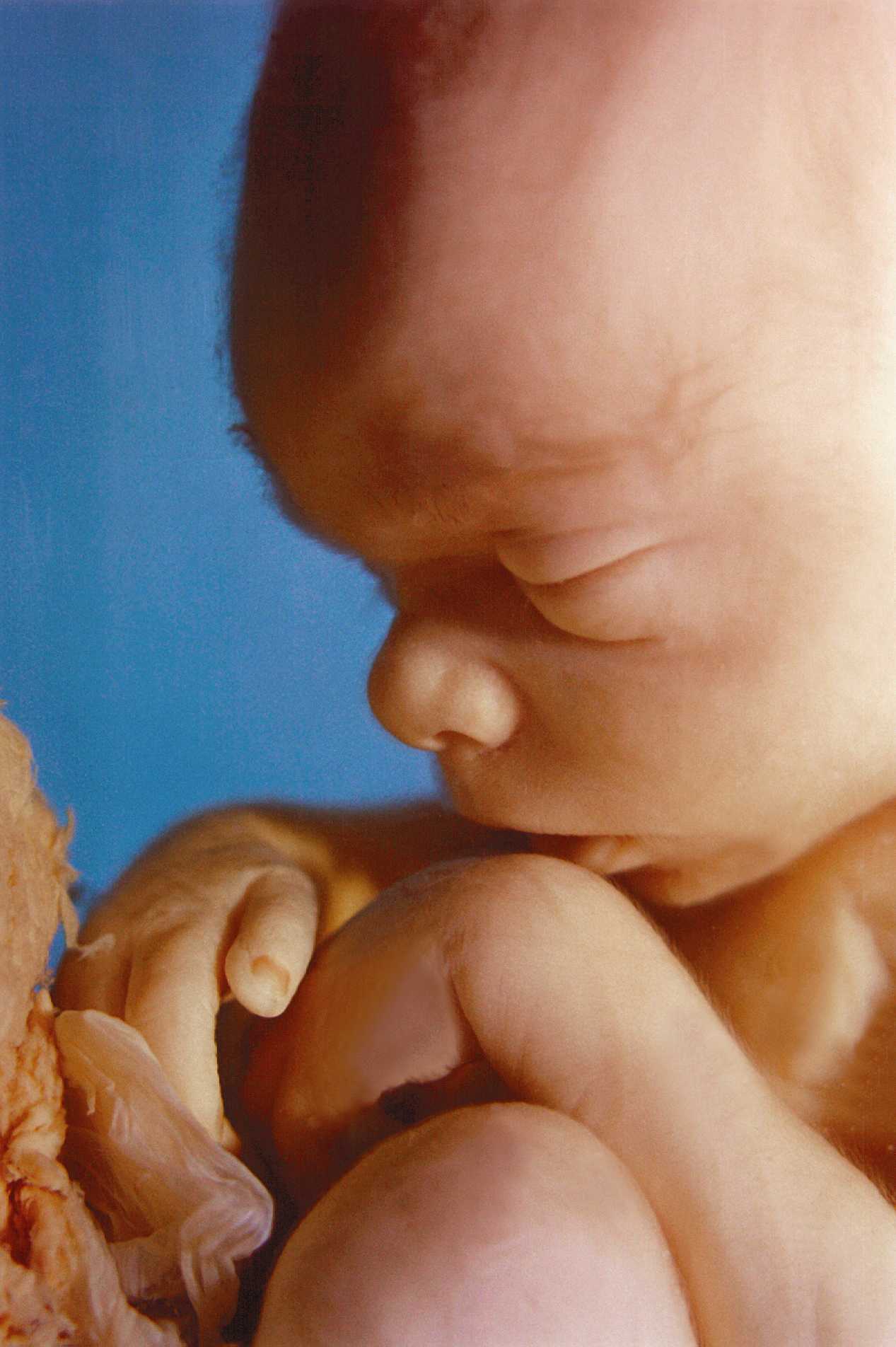 picture of human fetus