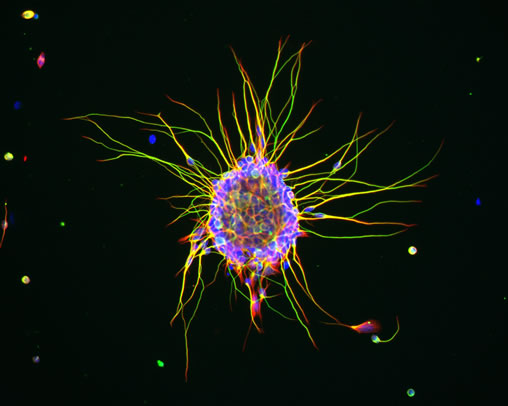 picture of virus